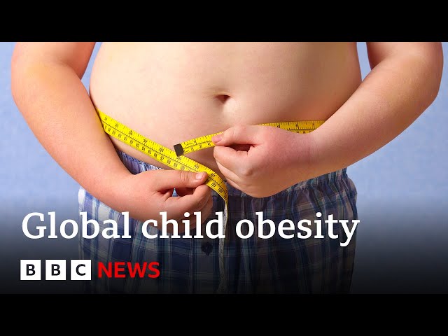 More children are obese than underweight, says Unicef | BBC News