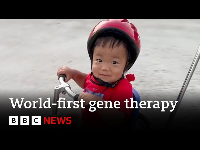 Boy with rare condition amazes doctors after world-first gene therapy | BBC News