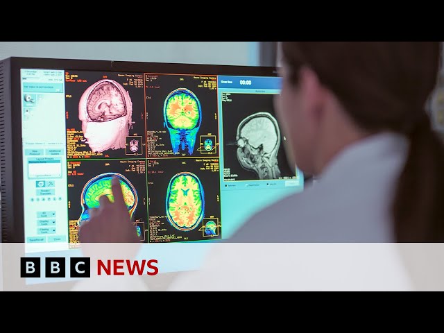 Adolescence lasts into 30s, new study shows | BBC News