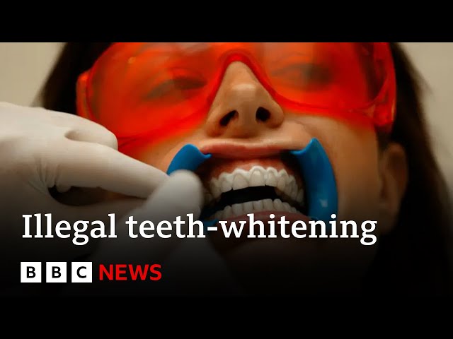 Illegal teeth-whitening industry exposed by BBC | BBC News