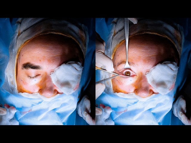 The Disturbing Cases of People Waking Up During Surgery